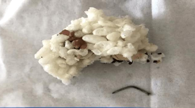 女子米花糖里吃出铁钉崩裂牙齿，应如何维权